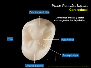 Primer Pre molar Superior
Cara oclusal
Cúspide vestibular
Cúspide palatina
Fosa mesial
Contornos mesial y distal
convergentes hacia palatino
Fosa
Surco principal
Kano, P., 2012, Desaﬁando la Naturaleza. Quintessence Ltda editorial, Brasil. Cap. 2, Pag. 3-24
 