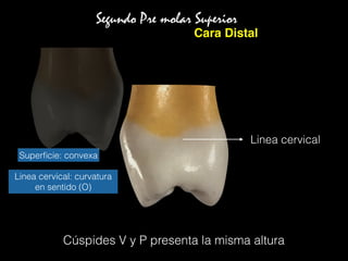 Cúspides V y P presenta la misma altura
Segundo Pre molar Superior
Cara Distal
Linea cervical
Superﬁcie: convexa
Linea cervical: curvatura
en sentido (O)
 