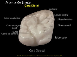 Cara Oclusal
Vertiente
Lóbulo central
Lóbulo laterales
Lóbulo central
Tubérculo
Puente de esmalte
Surco
Cresta marginal
distal
Arista longitudinal
Kano, P., 2012, Desaﬁando la Naturaleza. Quintessence Ltda editorial, Brasil. Cap. 2, Pag. 3-24
Primer molar Superior
Cara Distal
 
