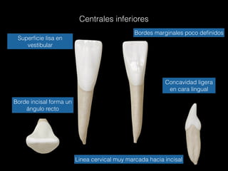 Centrales inferiores
Superﬁcie lisa en
vestibular
Bordes marginales poco deﬁnidos
Concavidad ligera
en cara lingual
Linea cervical muy marcada hacia incisal
Borde incisal forma un
ángulo recto
 