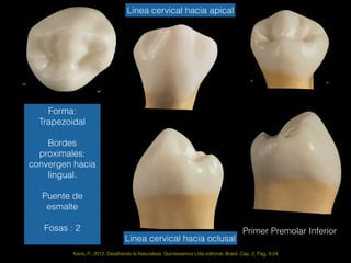 Primer Premolar Inferior
Kano, P., 2012, Desaﬁando la Naturaleza. Quintessence Ltda editorial, Brasil. Cap. 2, Pag. 3-24
Forma:
Trapezoidal
Bordes
proximales:
convergen hacia
lingual.
Puente de
esmalte
Fosas : 2
Linea cervical hacia apical
Linea cervical hacia oclusal
 