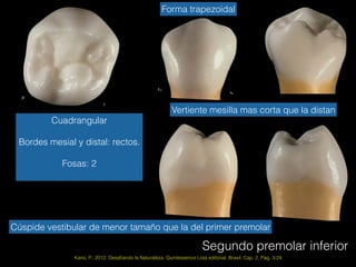 Segundo premolar inferior
Kano, P., 2012, Desaﬁando la Naturaleza. Quintessence Ltda editorial, Brasil. Cap. 2, Pag. 3-24
Cuadrangular
Bordes mesial y distal: rectos.
Fosas: 2
Vertiente mesilla mas corta que la distan
Forma trapezoidal
Cúspide vestibular de menor tamaño que la del primer premolar
 