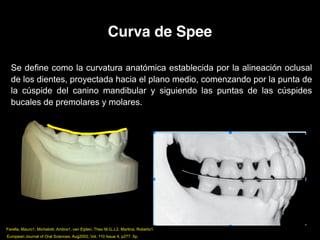 Curva de Spee
Se define como la curvatura anatómica establecida por la alineación oclusal
de los dientes, proyectada hacia el plano medio, comenzando por la punta de
la cúspide del canino mandibular y siguiendo las puntas de las cúspides
bucales de premolares y molares.
Farella, Mauro1, Michelotti, Ambra1, van Eijden, Theo M.G.J.2, Martina, Roberto1
European Journal of Oral Sciences. Aug2002, Vol. 110 Issue 4, p277. 5p.
 