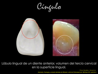 Cíngulo
Lóbulo lingual de un diente anterior, volumen del tercio cervical
en la superficie lingual.
Anatomía, fisiología y oclusión dentales de Wheeler; editorial Interamerican McGraw-Hill: capitulo 6
Photo: BoneBox - Dental Lite
 