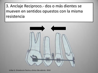 3. Anclaje Reciproco.- dos o más dientes se
mueven en sentidos opuestos con la misma
resistencia

Uribe G. Ortodoncia Teoría y clínica 2da edición. 2010

 