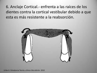 6. Anclaje Cortical.- enfrenta a las raíces de los
dientes contra la cortical vestibular debido a que
esta es más resistente a la reabsorción.

Uribe G. Ortodoncia Teoría y clínica 2da edición. 2010

 