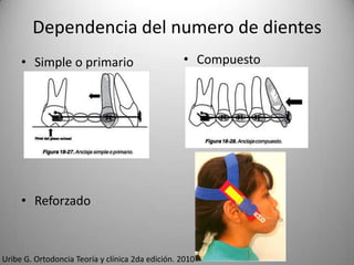 Dependencia del numero de dientes
• Simple o primario

• Compuesto

• Reforzado

Uribe G. Ortodoncia Teoría y clínica 2da edición. 2010

 