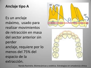 Anclaje tipo A

Es un anclaje
máximo, usado para
realizar movimientos
de retracción en masa
del sector anterior sin
perder
anclaje, requiere por lo
menos del 75% del
espacio de la
extracción.

40˚

20˚

Nanda Ravindra. Biomecánicas y estética. Estrategias en ortodoncia clínica

 