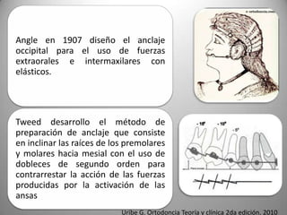 Angle en 1907 diseño el anclaje
occipital para el uso de fuerzas
extraorales e intermaxilares con
elásticos.

Tweed desarrollo el método de
preparación de anclaje que consiste
en inclinar las raíces de los premolares
y molares hacia mesial con el uso de
dobleces de segundo orden para
contrarrestar la acción de las fuerzas
producidas por la activación de las
ansas
Uribe G. Ortodoncia Teoría y clínica 2da edición. 2010

 