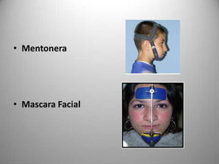• Mentonera

• Mascara Facial

 