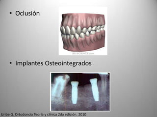 • Oclusión

• Implantes Osteointegrados

Uribe G. Ortodoncia Teoría y clínica 2da edición. 2010

 