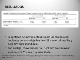 RESULTADOS

• La cantidad de movimiento distal de los caninos con
implantes como anclaje fue de 4,29 mm en el maxilar y
4,10 mm en la mandíbula.
• Con anclaje convencional fue 3,79 mm en el maxilar
superior y 3,75 mm en la mandíbula.
Badri Thrivenkatachary, Pavithranand Ammayappan, Rajasigamani Kandaswamyc. Am J Orthod Dentofacial Orthop
2008; 134:30 - 5

 