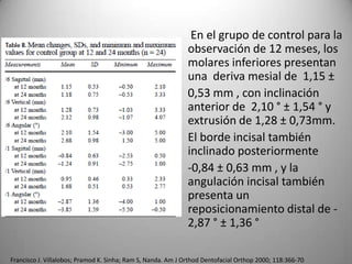 En el grupo de control para la
observación de 12 meses, los
molares inferiores presentan
una deriva mesial de 1,15 ±
0,53 mm , con inclinación
anterior de 2,10 ° ± 1,54 ° y
extrusión de 1,28 ± 0,73mm.
El borde incisal también
inclinado posteriormente
-0,84 ± 0,63 mm , y la
angulación incisal también
presenta un
reposicionamiento distal de 2,87 ° ± 1,36 °
Francisco J. Villalobos; Pramod K. Sinha; Ram S, Nanda. Am J Orthod Dentofacial Orthop 2000; 118:366-70

 