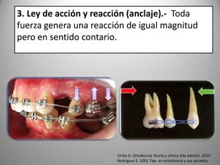 3. Ley de acción y reacción (anclaje).- Toda
fuerza genera una reacción de igual magnitud
pero en sentido contario.

Uribe G. Ortodoncia Teoría y clínica 2da edición. 2010
Rodriguez E. 1001 Tips en ortodoncia y sus secretos

 