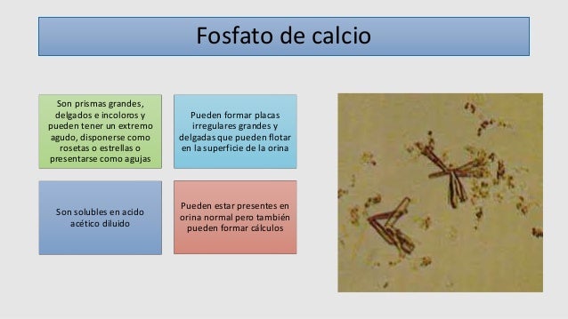 Analisis microscopico del sedimento urinario