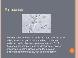 Analisis Microscopico De Orina PPTX analisis-microscopico-de-orina-pptx