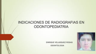 INDICACIONES DE RADIOGRAFIAS EN
ODONTOPEDIATRIA
ENRIQUE VELASQUEZ ROSAS
ODONTOLOGIA
 
