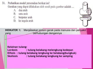 TedY
SKL 12: 6 INDIKATOR
SKL : Menjelaskan sistem organ pada manusia
INDIKATOR 1: Menjelaskan sistem gerak pada manusia dan penyakit
yang berhubungan dengannya
29
C1 PENGETAHUAN/
C2 PEMAHAMAN
MENJELASKAN, menerangkan
menyimpulkan
Fungsi rangka
Bentuk tulang: pipa: (lengan, betis, paha, selangka, hasta,
pengumpil, telapak jari), pipih: rusuk, tengkorak, belikat, pendek:
ruas jari, ruas tulang belakang, pergelangan
Macam sendi: Sendi mati (sinartrosis), sendi kaku (amfiartrosis) dan
sendi gerak (diartrosis).
Macam sendi gerak : Engsel: siku,lutut, jari. Putar: tulang pengumpil
dengan tulang hasta. Pelana: ibu jari dengan telapak tangan. Peluru:
bahu dendan lengan, panggul dengan paha
Perbedaan otot polos, otot lurik dan otot jantung, Kerja otot antagonis
pada lengan
Kelainan tulang:
Lordosis : tulang belakang melengkung kedepan
Kifosis : tulang belakang lengkung ke belakang(bungkuk)
Skoliosis : tulang belakang lengkung ke samping
 