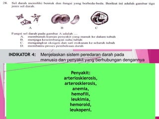 TedY
SKL 12: 6 INDIKATOR
SKL : Menjelaskan sistem organ pada manusia
INDIKATOR 4: Menjelaskan sistem peredaran darah pada
manusia dan penyakit yang berhubungan dengannya
32
C1 PENGETAHUAN/
C2 PEMAHAMAN
MENJELASKAN, menerangkan
menyimpulkan
Alat: jantung pembuluh darah (vena,arteri,kapiler)
Sistem peredaran darah manusia dikenal sebagai peredaran darah ganda karena sekali
edar, darah melewati jantung 2 kali.
Peredaran ganda ada 2 macam:
Peredaran darah besar: jantung (bilik kiri) tubuh  jantung (serambi kanan)
Peredaran darah kecil: jantung (bilik kanan)  tubuh  jantung (serambi kiri)
Sel darah ada 3 macam:
Eritrosit (sel darah merah): sebagai pengangkut.
Leukosit (sel darh putih): antibdi//membunuh kuman
Trombosit (keping darah): pembekuan darah
Penyakit:
arteriosklerosis,
arterosklerosis,
anemia,
hemofili,
leukimia,
hemoroid,
leukopeni.
 