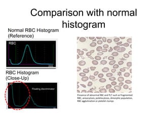 Dimorphic Rbc Graph Sysmex Analizadores Hematológicos Flags and Troubleshooting.pdf