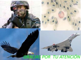 GRACIAS POR TU ATENCIÓN
 