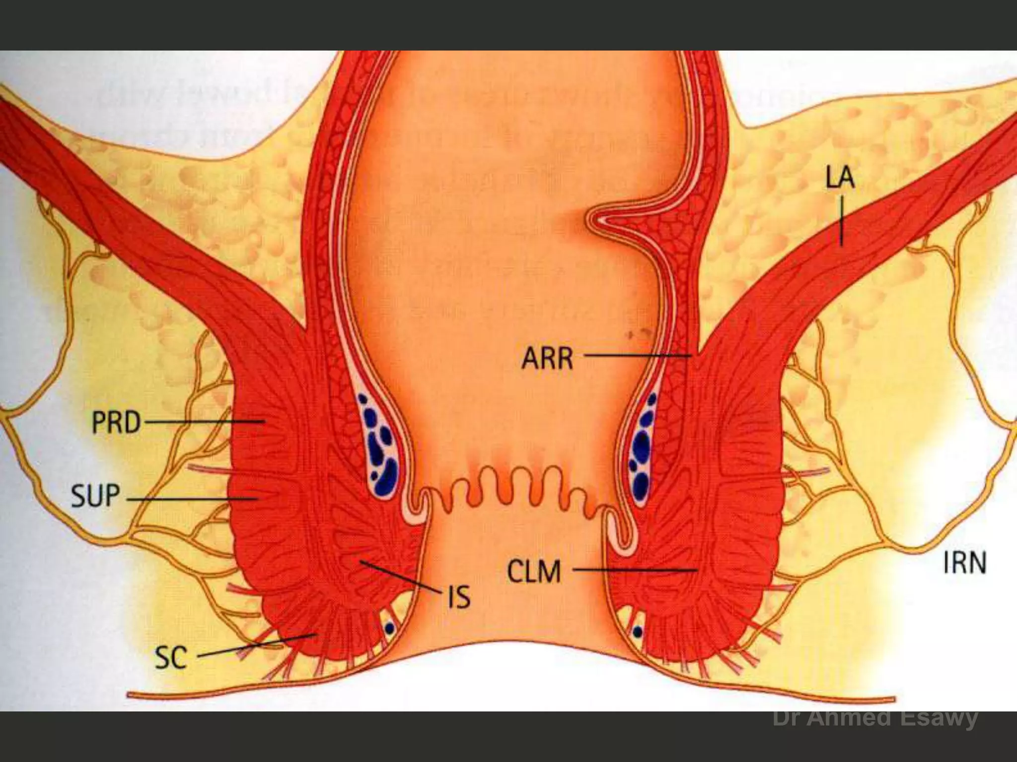 Anal perianal imaging part 1 CT MRI anatomy Dr Ahmed Esawy | PDF