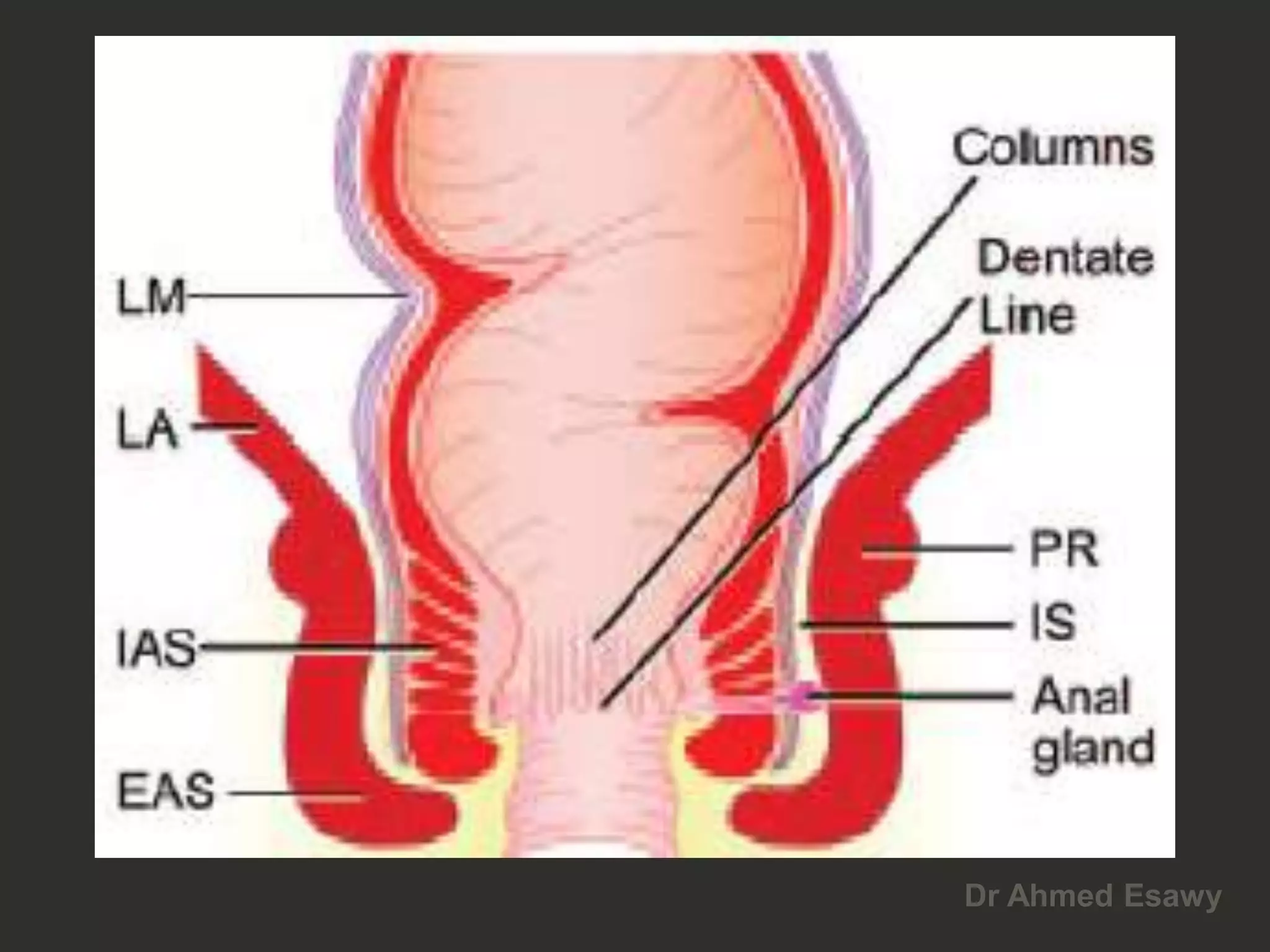 Anal perianal imaging part 1 CT MRI anatomy Dr Ahmed Esawy | PDF