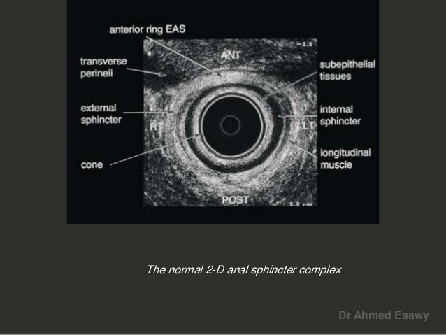 Anal perianal imaging part 1 CT MRI anatomy Dr Ahmed Esawy