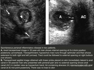 Anal perianal imaging part 4 in faecal continence CT MRI Dr Ahmed Esawy ...