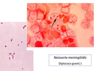 Neisseria meningitidis
   Diplococo gram(-)
 