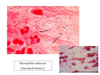 Haemophilus influenzae
 Coco bacilo Gram (-)
 
