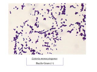 Listeria monocytogenes
   Bacilo Gram (+)
 