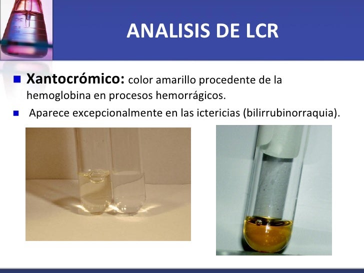 Analsis liquido cefalorraquideo final