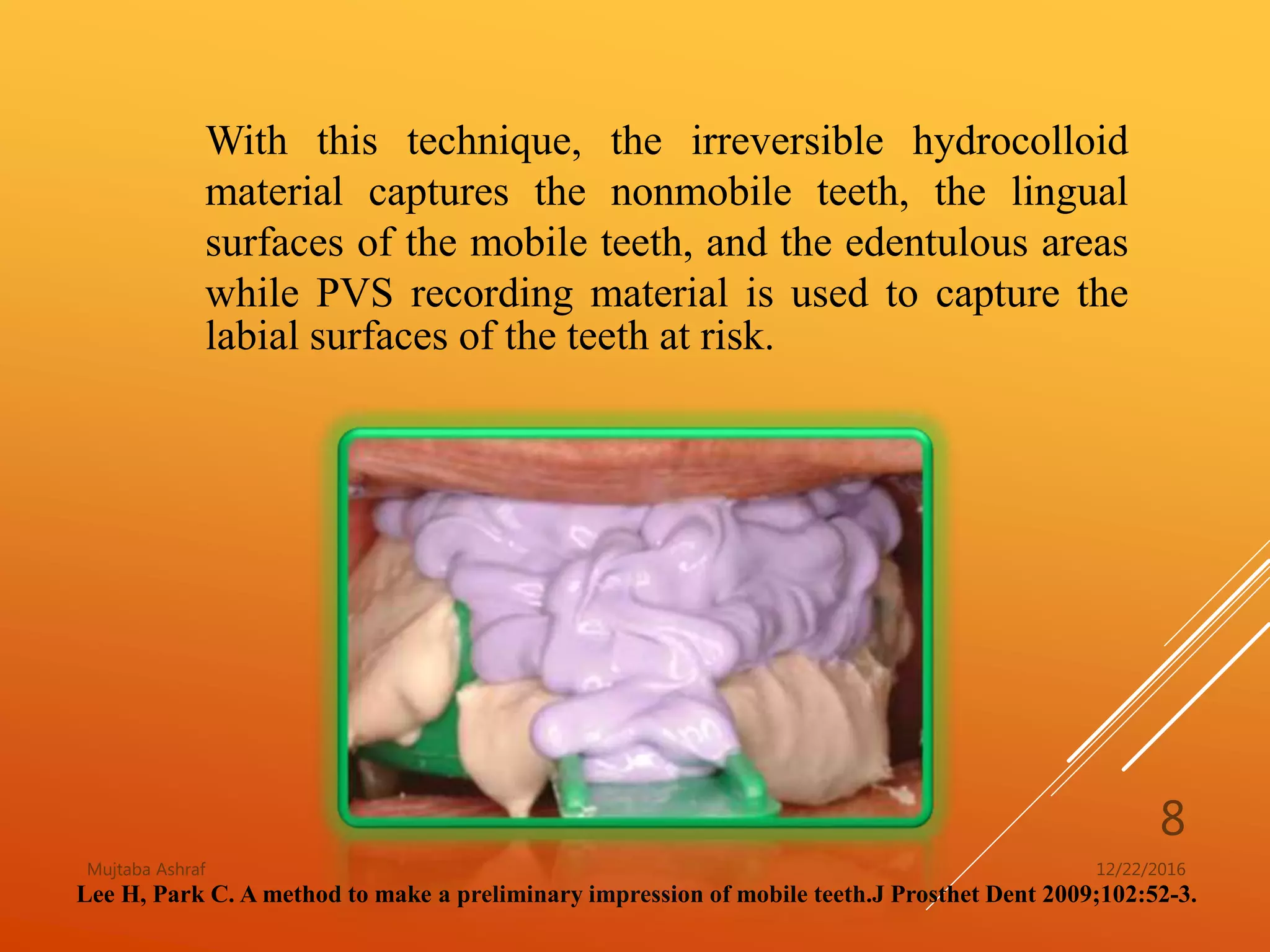 An alternative impression technique for mobile teeth | PPTX