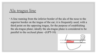 An Alternative Technique For Transferring Ala‑tragus[1].pptx