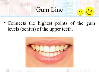 Gum Line
• Connects the highest points of the gum
levels (zenith) of the upper teeth.
 