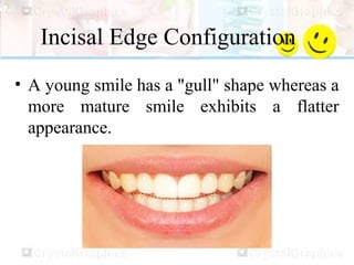 Incisal Edge Configuration
• A young smile has a "gull" shape whereas a
more mature smile exhibits a flatter
appearance.
 