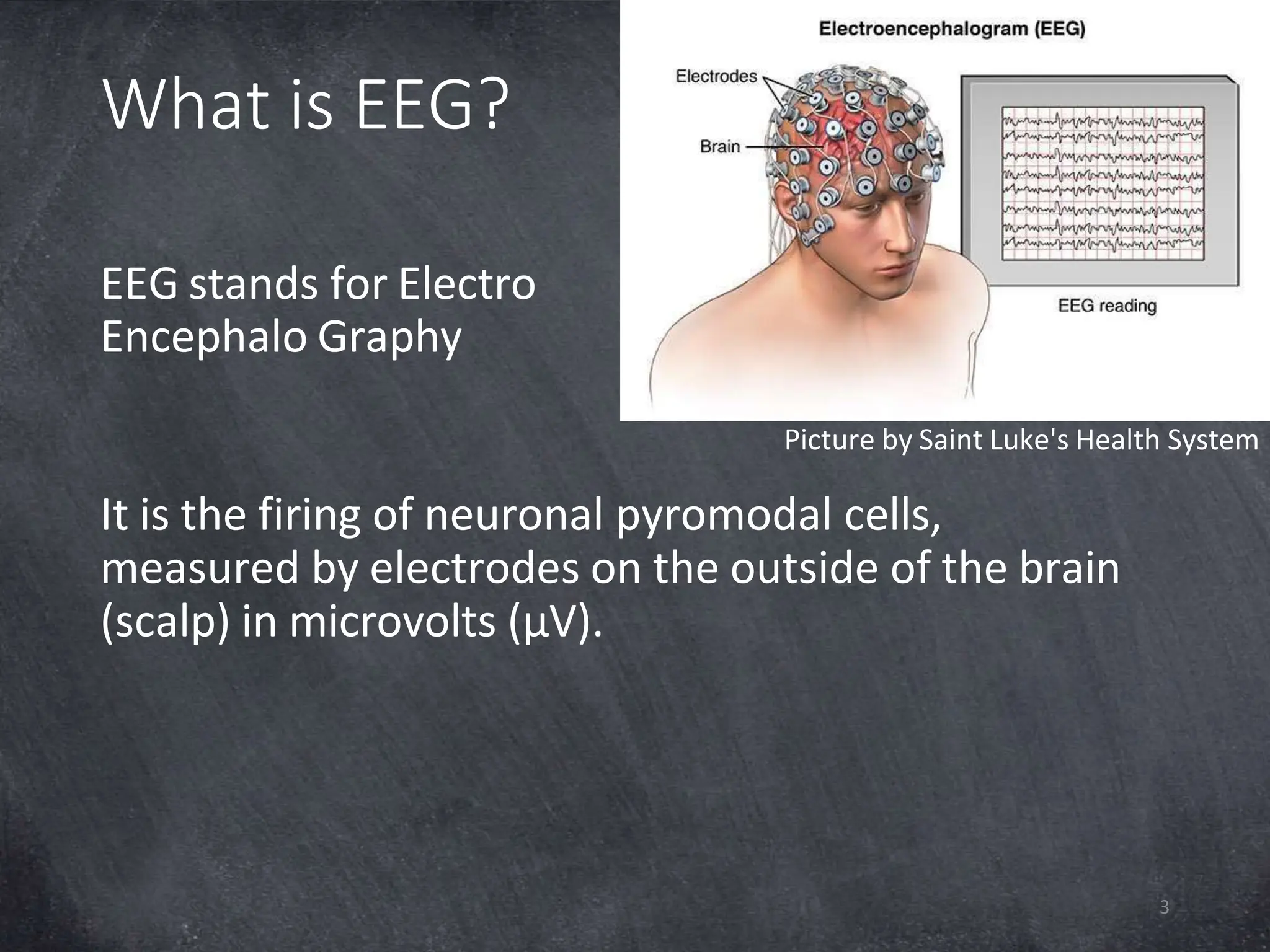 What is EEG?
EEG stands for Electro
Encephalo Graphy
It is the firing of neuronal pyromodal cells,
measured by electrodes on the outside of the brain
(scalp) in microvolts (µV).
Picture by Saint Luke's Health System
3
 