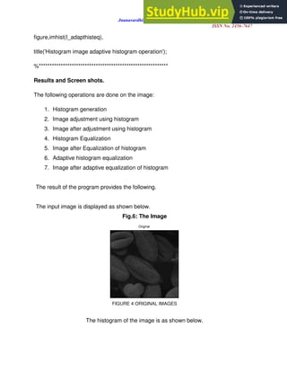 ANALYSIS OF IMAGE ENHANCEMENT TECHNIQUES USING MATLAB | PDF