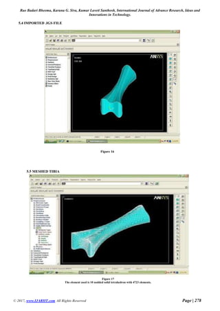 Analysis of knee joint in various postures and finite element analysis ...
