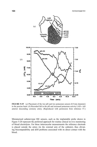 Miniaturized catheter-type ISE sensors, such as the implantable probe shown in
Figure 5-20 represent the preferred approach for routine clinical in-vivo monitoring
of blood electrolytes. For these intravascular measurements the reference electrode
is placed outside the artery (in the external arm of the catheter), thus obviat-
ing biocompatability and drift problems associated with its direct contact with the
blood.
FIGURE 5-19 (a) Placement of the two pH and two potassium sensors (0.5 mm diameter)
in the porcine heart. (b) Recorded fall in the pH and increased potassium activity LAD ˆ left
anterior descending coronory artery. (Reproduced with permission from reference 57.)
164 POTENTIOMETRY
 