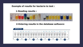 Analytical Profile Index 20E.pptx | Chemistry | Science