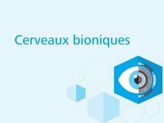 Cerveaux bioniques
 