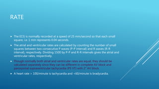 Analyze an Electrocardiogram | PPTX