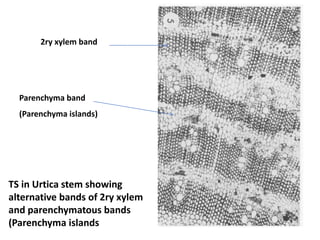 TS in Urtica stem showing
alternative bands of 2ry xylem
and parenchymatous bands
(Parenchyma islands
Parenchyma band
(Parenchyma islands)
2ry xylem band
 