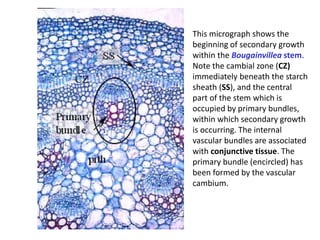 This micrograph shows the
beginning of secondary growth
within the Bougainvillea stem.
Note the cambial zone (CZ)
immediately beneath the starch
sheath (SS), and the central
part of the stem which is
occupied by primary bundles,
within which secondary growth
is occurring. The internal
vascular bundles are associated
with conjunctive tissue. The
primary bundle (encircled) has
been formed by the vascular
cambium.
 