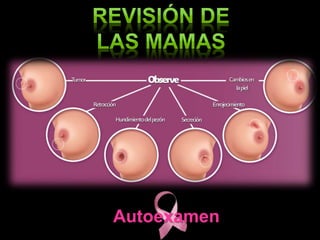 Autoexamen
 