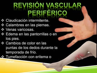  Claudicación intermitente.
 Calambres en las piernas.
 Venas varicosas.
 Edema en las pantorrillas o en
los pies.
 Cambios de color en las
puntas de los dedos durante la
temporada de frío.
 Tumefacción con eritema o
dolor.
 