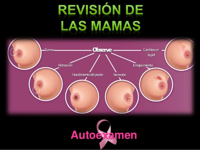 Duele fuerte la espalda a la izquierda