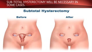SUB-TOTAL HYSTERECTOMY WILL BE NECESSARY IN
SOME CASES.
 